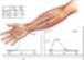 /clinical/trauma_hand.jpeg
